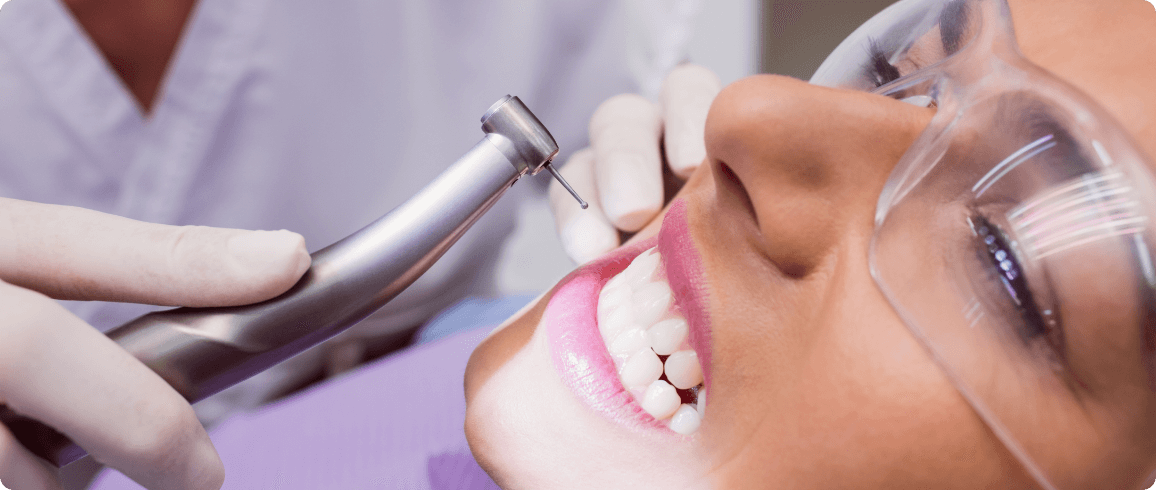 Ciscenje zobnega kamna z ultrazvocnim cistilcem NS