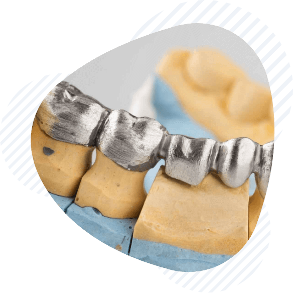 zobna protetika