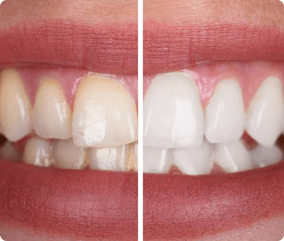 2. zabarvanje zob